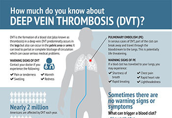 Association Between Varicose Veins and DVT