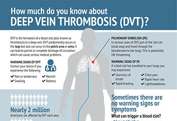 These 5 Factors Put You More at Risk for Deep Vein Thrombosis