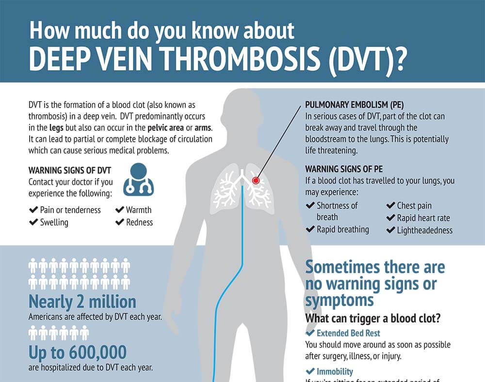 Critical Symptoms Of Deep Vein Thrombosis You Should Know - ACTIV LIVING  COMMUNITY